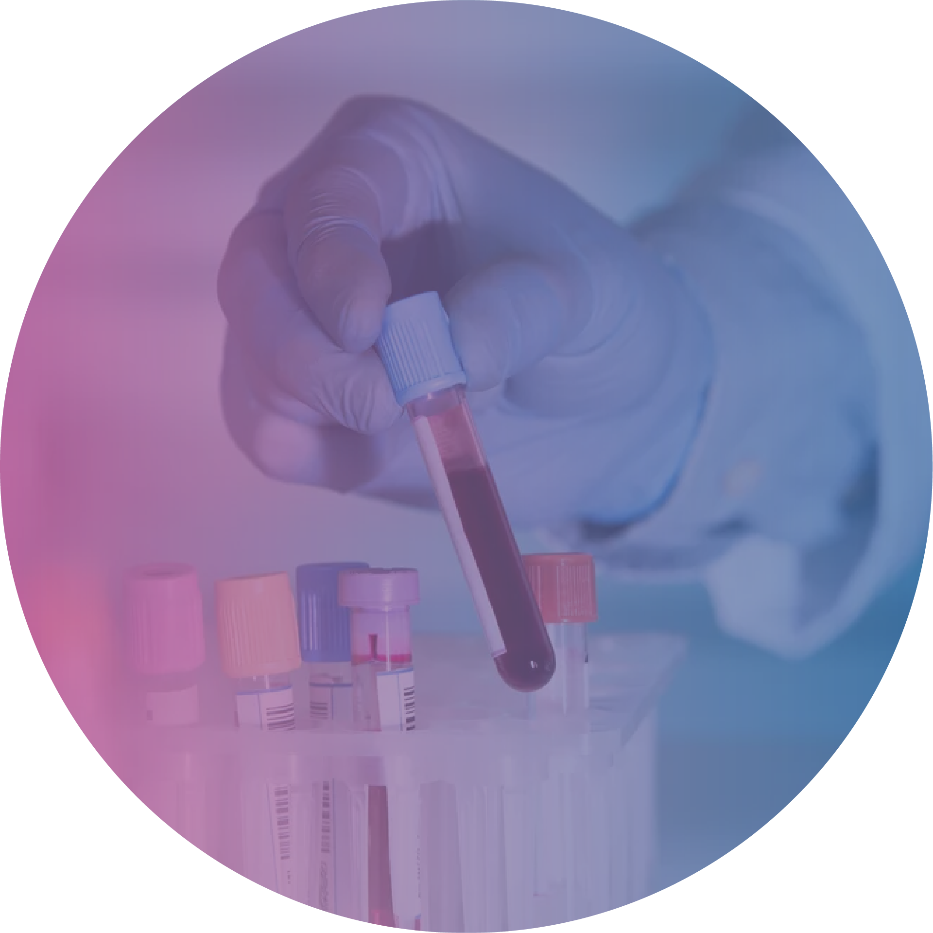 Suero Fetal Bovino FBS Biowest Your Best Choice For Animal Serum